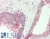 SLCO5A1 Antibody - Human Prostate: Formalin-Fixed, Paraffin-Embedded (FFPE).  This image was taken for the unconjugated form of this product. Other forms have not been tested.