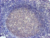 SLFNL1 Antibody - IHC of paraffin-embedded Human tonsil using anti-SLFNL1 mouse monoclonal antibody.