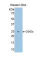 SLIT1 Antibody - Western blot of recombinant SLIT1 / SLIT-1.  This image was taken for the unconjugated form of this product. Other forms have not been tested.