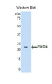 SLIT2 Antibody - Western blot of recombinant SLIT2 / SLIT-2.  This image was taken for the unconjugated form of this product. Other forms have not been tested.