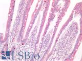 SLIT3 Antibody - Human Small Intestine: Formalin-Fixed, Paraffin-Embedded (FFPE)