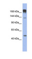 SLIT3 Antibody - SLIT3 antibody Western blot of Fetal Muscle lysate. This image was taken for the unconjugated form of this product. Other forms have not been tested.