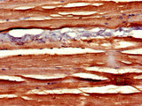 SLIT3 Antibody - Immunohistochemistry of paraffin-embedded human skeletal muscle tissue at dilution of 1:100