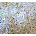 SLITRK1 Antibody - Immunohistochemistry of Slitrk1 in mouse brain tissue with Slitrk1 Antibodyat 5 µg/mL.
