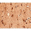 SLITRK3 Antibody - Immunohistochemistry of Slitrk3 in human brain tissue with Slitrk3 antibody at 2.5 µg/mL