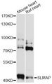 SLMAP / SLAP Antibody - Western blot analysis of extracts of various cell lines, using SLMAP antibody at 1:3000 dilution. The secondary antibody used was an HRP Goat Anti-Rabbit IgG (H+L) at 1:10000 dilution. Lysates were loaded 25ug per lane and 3% nonfat dry milk in TBST was used for blocking. An ECL Kit was used for detection and the exposure time was 30s.