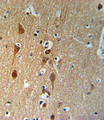 SMAD3 Antibody - SMAD3-S208 Antibody IHC of formalin-fixed and paraffin-embedded brain tissue followed by peroxidase-conjugated secondary antibody and DAB staining.