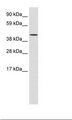 SMARCA1 / SWI Antibody - NIH 3T3 Cell Lysate.  This image was taken for the unconjugated form of this product. Other forms have not been tested.