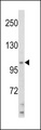 SMARCA3 / HLTF Antibody - Western blot of HIP116A Antibody in HL60 cell line lysates (35 ug/lane). HIP116A (arrow) was detected using the purified antibody.