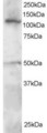 SMARCA3 / HLTF Antibody - Antibody staining (0.5 ug/ml) of Jurkat lysate (RIPA buffer, 30 ug total protein per lane). Primary incubated for 1 hour. Detected by Western blot of chemiluminescence.