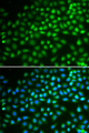 SMARCA5 / SNF2H Antibody - Immunofluorescence analysis of HeLa cells.