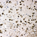 SMARCB1 / INI1 Antibody - SMARCB1 / INI1 antibody. IHC(P): Rat Brain Tissue.