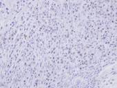 SMC1B Antibody - IHC of paraffin-embedded SAS xenograft using SMC1B antibody at 1:500 dilution.