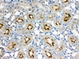 SMC3 / HCAP Antibody