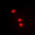 SMCHD1 Antibody - Immunofluorescent analysis of SMCHD1 staining in MCF7 cells. Formalin-fixed cells were permeabilized with 0.1% Triton X-100 in TBS for 5-10 minutes and blocked with 3% BSA-PBS for 30 minutes at room temperature. Cells were probed with the primary antibody in 3% BSA-PBS and incubated overnight at 4 deg C in a humidified chamber. Cells were washed with PBST and incubated with a DyLight 594-conjugated secondary antibody (red) in PBS at room temperature in the dark.