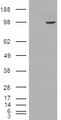 SMEK1 Antibody - HEK293 overexpressing SMEK1 (RC221040) and probed with (mock transfection in first lane).