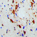 SMG7 Antibody - Immunohistochemical analysis of SMG7 staining in human brain formalin fixed paraffin embedded tissue section. The section was pre-treated using heat mediated antigen retrieval with sodium citrate buffer (pH 6.0). The section was then incubated with the antibody at room temperature and detected using an HRP conjugated compact polymer system. DAB was used as the chromogen. The section was then counterstained with hematoxylin and mounted with DPX.