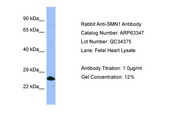 SMN1 Antibody -  This image was taken for the unconjugated form of this product. Other forms have not been tested.