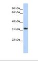SMNDC1 Antibody - 721_B cell lysate. Antibody concentration: 1.0 ug/ml. Gel concentration: 12%.  This image was taken for the unconjugated form of this product. Other forms have not been tested.