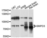 SMPD3 / NSMASE2 Antibody - Western blot analysis of extracts of various cell lines, using SMPD3 antibody at 1:1000 dilution. The secondary antibody used was an HRP Goat Anti-Rabbit IgG (H+L) at 1:10000 dilution. Lysates were loaded 25ug per lane and 3% nonfat dry milk in TBST was used for blocking. An ECL Kit was used for detection and the exposure time was 10s.