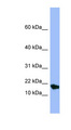SMR3A Antibody - SMR3A antibody Western blot of Fetal Small Intestine lysate. This image was taken for the unconjugated form of this product. Other forms have not been tested.