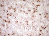SMURF2 Antibody - IHC of paraffin-embedded Human liver tissue using anti-SMURF2 mouse monoclonal antibody. (Heat-induced epitope retrieval by 1 mM EDTA in 10mM Tris, pH8.5, 120°C for 3min).