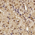 SMYD1 Antibody - Immunohistochemical analysis of SMYD1 staining in rat kidney formalin fixed paraffin embedded tissue section. The section was pre-treated using heat mediated antigen retrieval with sodium citrate buffer (pH 6.0). The section was then incubated with the antibody at room temperature and detected using an HRP conjugated compact polymer system. DAB was used as the chromogen. The section was then counterstained with hematoxylin and mounted with DPX.