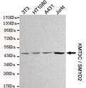 SMYD2 Antibody - Western blot detection of KMT3C / SMYD2 in 3T3, HT1080, A431 and Jurkat cell lysates and using KMT3C / SMYD2 mouse monoclonal antibody (1:1000 dilution). Predicted band size: 50KDa. Observed band size: 50KDa.