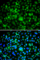 SMYD3 Antibody - Immunofluorescence analysis of MCF7 cells.