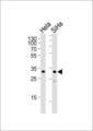 SNAI1 / SNAIL-1 Antibody - Western blot of lysates from HeLa, SiHa cell line (from left to right), using SNAI1 Antibody (N-term R8). Antibody was diluted at 1:1000 at each lane. A goat anti-rabbit IgG H&L (HRP) at 1:5000 dilution was used as the secondary antibody. Lysates at 35ug per lane.