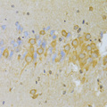 SNAI2 / SLUG Antibody - Immunohistochemistry of paraffin-embedded rat brain using SNAI2 Antibodyat dilution of 1:100 (40x lens).