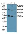 SNAP23 / SNAP-23 Antibody - Western Blot; Sample: Lane1: Human Lung Tissue; Lane2: Human Hela Cells; Lane3: Mouse Placenta Tissue.