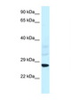 SNF8 / EAP30 Antibody - SNF8 / EAP30 antibody Western blot of Rat Liver lysate. Antibody concentration 1 ug/ml.  This image was taken for the unconjugated form of this product. Other forms have not been tested.