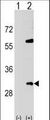 SNF8 / EAP30 Antibody - Western blot of SNF8 (arrow) using rabbit polyclonal SNF8 Antibody. 293 cell lysates (2 ug/lane) either nontransfected (Lane 1) or transiently transfected (Lane 2) with the SNF8 gene.