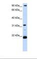 SNF8 / EAP30 Antibody - Hela cell lysate. Antibody concentration: 1.0 ug/ml. Gel concentration: 12%.  This image was taken for the unconjugated form of this product. Other forms have not been tested.