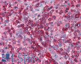 SNF8 / EAP30 Antibody - Anti-SNF8 / EAP30 antibody IHC of human spleen. Immunohistochemistry of formalin-fixed, paraffin-embedded tissue after heat-induced antigen retrieval. Antibody concentration 5 ug/ml.  This image was taken for the unconjugated form of this product. Other forms have not been tested.