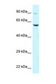 SNK / PLK2 Antibody - PLK2 antibody Western blot of Jurkat Cell lysate. Antibody concentration 1 ug/ml.  This image was taken for the unconjugated form of this product. Other forms have not been tested.