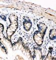 SNK / PLK2 Antibody - SNK / PLK2 antibody. IHC(P): Rat Intestine Tissue.
