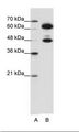 SNRP70 / SNRNP70 Antibody - B: HepG2 Cell Lysate.  This image was taken for the unconjugated form of this product. Other forms have not been tested.