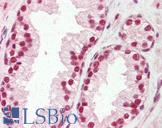 SNRPA / U1A Antibody - Anti-SNRPA antibody IHC of human prostate. Immunohistochemistry of formalin-fixed, paraffin-embedded tissue after heat-induced antigen retrieval. Antibody concentration 5 ug/ml.  This image was taken for the unconjugated form of this product. Other forms have not been tested.