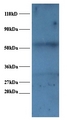 SNRPA / U1A Antibody - Western blot of U1 small nuclear ribonucleoprotein A polyclonal Antibody at 2 ug/ml + EC109 whole cell lysate at 20 ug. Secondary: Goat polyclonal to Rabbit IgG at 1:15000 dilution. Predicted band size: 31 kDa. Observed band size: 31 kDa Additional bands at: 52 kDa. We are unsure as to the identity of this extra band.  This image was taken for the unconjugated form of this product. Other forms have not been tested.