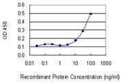 SNRPB / COD Antibody - Detection limit for recombinant GST tagged SNRPB is 3 ng/ml as a capture antibody.