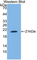 SNRPC / U1C Antibody - Western blot of recombinant SNRPC / U1C.