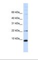 SNRPF Antibody - MCF7 cell lysate. Antibody concentration: 1.0 ug/ml. Gel concentration: 10-20%.  This image was taken for the unconjugated form of this product. Other forms have not been tested.