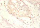 SNRPG Antibody - Immunohistochemistry of paraffin-embedded human mammary gland tissue using 01535A0Rb at dilution of 1:50