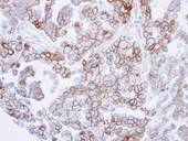 SNTB2 Antibody - IHC of paraffin-embedded OVCAR3 xenograft using SNTB2 antibody at 1:500 dilution.