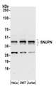 SNUPN Antibody - Detection of human SNUPN by western blot. Samples: Whole cell lysate (15 µg) from HeLa, HEK293T, and Jurkat cells prepared using NETN lysis buffer. Antibody: Affinity purified rabbit anti-SNUPN antibody used for WB at 0.1 µg/ml. Detection: Chemiluminescence with an exposure time of 30 seconds.