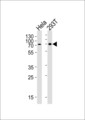 SNX1 Antibody - Western blot of lysates from HeLa, 293T cell line (from left to right), using SNX1 Antibody. Antibody was diluted at 1:1000 at each lane. A goat anti-rabbit IgG H&L (HRP) at 1:5000 dilution was used as the secondary antibody. Lysates at 35ug per lane.