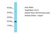 SNX12 Antibody -  This image was taken for the unconjugated form of this product. Other forms have not been tested.