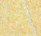 SNX14 Antibody - Immunohistochemistry of paraffin-embedded human liver tissue at dilution of 1:100